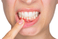 DentalPark: лечение десен народными средствами